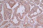 HSP90 beta Antibody in Immunohistochemistry (Paraffin) (IHC (P))