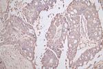 E-cadherin Recombinant Mouse Monoclonal Antibody (30B12)
