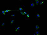 Vimentin Recombinant Rabbit Monoclonal Antibody (7E2)