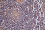 Vimentin Antibody in Immunohistochemistry (Paraffin) (IHC (P))