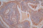 Vimentin Antibody in Immunohistochemistry (Paraffin) (IHC (P))