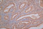 PRDX2 Antibody in Immunohistochemistry (Paraffin) (IHC (P))