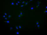 AXL Antibody in Immunocytochemistry (ICC/IF)
