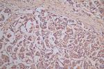 CRMP2 Antibody in Immunohistochemistry (Paraffin) (IHC (P))