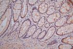 Synaptophysin Antibody in Immunohistochemistry (Paraffin) (IHC (P))
