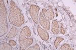 CD138 Antibody in Immunohistochemistry (Paraffin) (IHC (P))