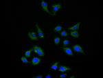 TIM-3 Recombinant Human Monoclonal Antibody (7G7)