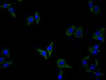 CSF2RB Antibody in Immunocytochemistry (ICC/IF)