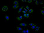 CSF2RB Recombinant Human Monoclonal Antibody (9C9)