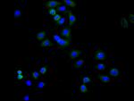 TRAIL-R2 (DR5) Antibody in Immunocytochemistry (ICC/IF)