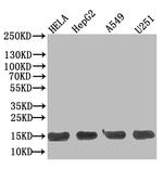 TRAIL-R2 (DR5) Antibody in Western Blot (WB)