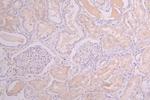 HGF Recombinant Human Monoclonal Antibody (9H7)