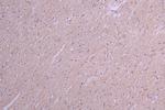 IL-22 Antibody in Immunohistochemistry (Paraffin) (IHC (P))