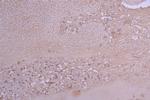 MCP-1 Antibody in Immunohistochemistry (Paraffin) (IHC (P))