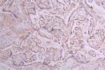 ITGA5 Antibody in Immunohistochemistry (Paraffin) (IHC (P))