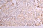 KIR2DL1 Antibody in Immunohistochemistry (Paraffin) (IHC (P))