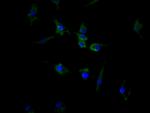 ACVR2B Recombinant Human Monoclonal Antibody (7E5)