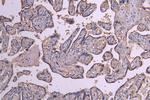 ACVR2B Antibody in Immunohistochemistry (Paraffin) (IHC (P))