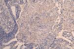 ACVR2B Antibody in Immunohistochemistry (Paraffin) (IHC (P))