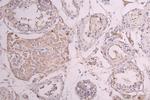 CSF3R Antibody in Immunohistochemistry (Paraffin) (IHC (P))