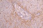 CD14 Recombinant Human Monoclonal Antibody (3F11)