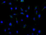 ASCT2 Antibody in Immunocytochemistry (ICC/IF)