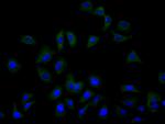 ASCT2 Recombinant Human Monoclonal Antibody (4G12)