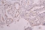 c-Kit Recombinant Human Monoclonal Antibody (6D4)