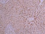 PCSK9 Recombinant Mouse Monoclonal Antibody (25G7)