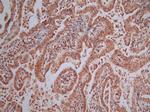 AIF Antibody in Immunohistochemistry (Paraffin) (IHC (P))