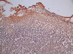 Granzyme B Recombinant Mouse Monoclonal Antibody (9B2)