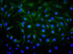 FGF1 Recombinant Mouse Monoclonal Antibody (23H4)