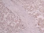 CD163 Recombinant Human Monoclonal Antibody (26F9)