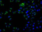 beta Tubulin Recombinant Human Monoclonal Antibody (16E11D4)