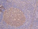 beta Tubulin Antibody in Immunohistochemistry (Paraffin) (IHC (P))