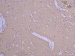 beta Tubulin Antibody in Immunohistochemistry (Paraffin) (IHC (P))