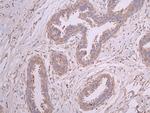 beta Tubulin Antibody in Immunohistochemistry (Paraffin) (IHC (P))