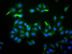 ILDR2 Antibody in Immunocytochemistry (ICC/IF)
