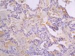 FGFR2 Antibody in Immunohistochemistry (Paraffin) (IHC (P))