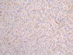 Serum Amyloid P Recombinant Human Monoclonal Antibody (25G7)