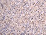 FCGRT Recombinant Human Monoclonal Antibody (23H4)