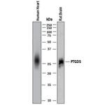 PTGDS Monoclonal Antibody (997303)