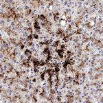 MT2A Monoclonal Antibody (1006811)