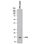 LTRIN Monoclonal Antibody (1009804)