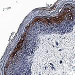 IFNK Monoclonal Antibody (1009725)