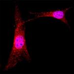 ABI1 Monoclonal Antibody (1013203)