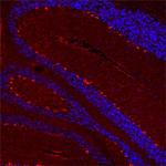 HTR2B Antibody in Immunohistochemistry (Paraffin) (IHC (P))