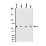 RIP2 Monoclonal Antibody (1018218)