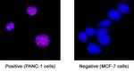 FOXL2 Monoclonal Antibody (1019104)