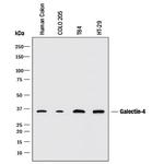 Galectin 4 Monoclonal Antibody (198616)